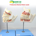 DENTAL22(12604) Huamn Children's Fetus Teeth Development Model with 4 Parts Dental Models